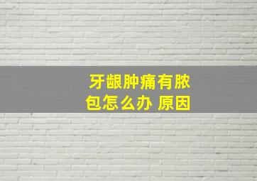 牙龈肿痛有脓包怎么办 原因